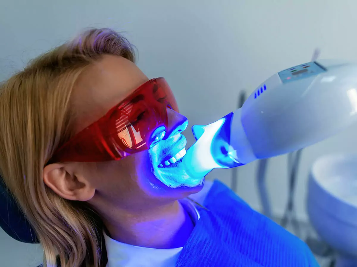 Teeth whitening in Waukesha, WI at Glo Dental Studio.