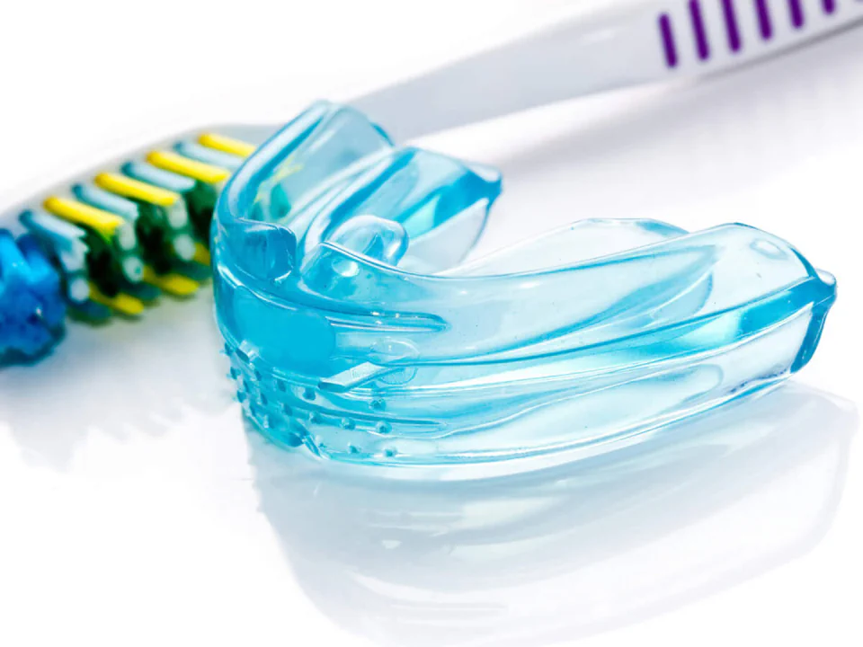 Mouthguards and dental night guards in Waukesha, WI at Glo Dental Studio.