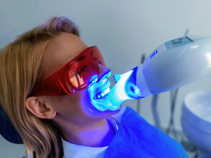 Teeth whitening in Waukesha, WI at Glo Dental Studio.