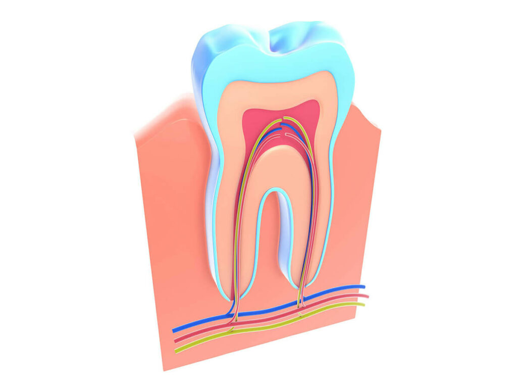 graphic of a root canal
