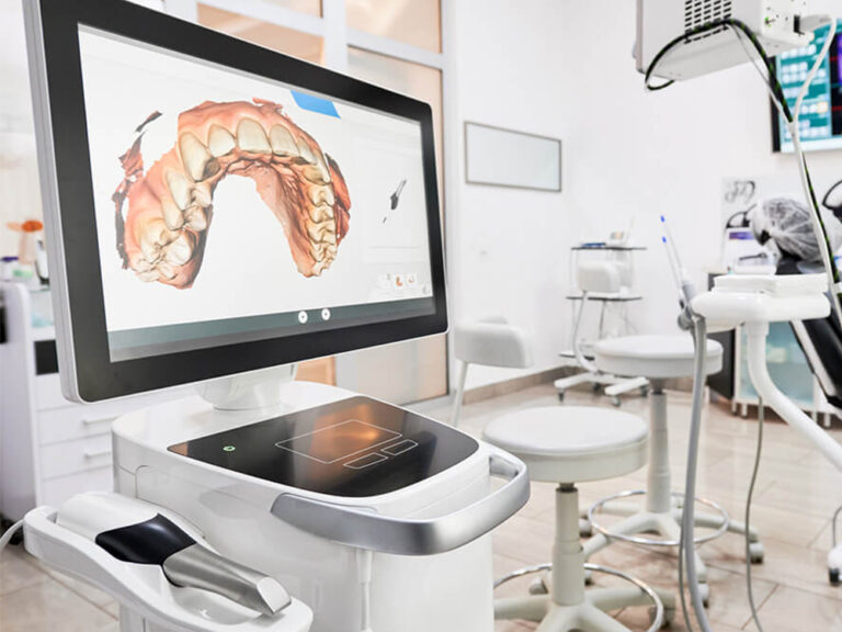 image of a cerec machine with a scan on the screen